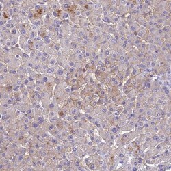 SLC13A5 Antibody, Novus Biologicals 0.1mL; Unlabeled:Antibodies, Polyclonal