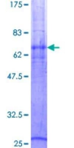 Novus Biologicals Recombinant Human SLC14A1 GST (N-Term) Protein 2 &mu;g | Buy Online | Novus Biologicals&trade; | Fisher Scientific