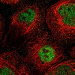 SLC15A4 Antibody, Novus Biologicals:Antibodies:Primary Antibodies