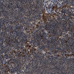 SLC15A4 Antibody, Novus Biologicals:Antibodies:Primary Antibodies