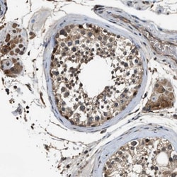 SLC15A4 Antibody, Novus Biologicals:Antibodies:Primary Antibodies