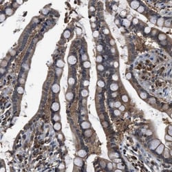SLC15A4 Antibody, Novus Biologicals:Antibodies:Primary Antibodies
