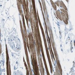 SLC16A10 Antibody, Novus Biologicals 0.1mL; Unlabeled:Antibodies, Polyclonal