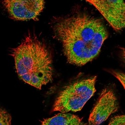 SLC16A14 Antibody, Novus Biologicals 0.1mL; Unlabeled:Antibodies, Polyclonal