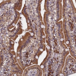SLC16A14 Antibody, Novus Biologicals 0.1mL; Unlabeled:Antibodies, Polyclonal