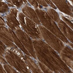 SLC16A3 Antibody, Novus Biologicals:Antibodies:Primary Antibodies
