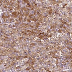 SLC16A9 Antibody, Novus Biologicals 0.1mL; Unlabeled:Antibodies, Polyclonal
