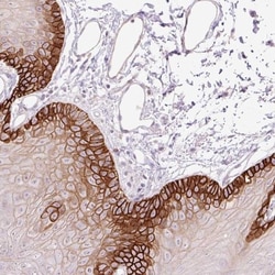 SLC1A4 Antibody, Novus Biologicals 25 &mu;L, Unlabeled:Antibodies, Polyclonal