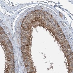 SLC1A5 Antibody, Novus Biologicals:Antibodies:Primary Antibodies