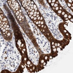 SLC20A2 Antibody, Novus Biologicals 0.1mL; Unlabeled:Antibodies, Polyclonal