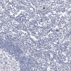 SLC22A12 Antibody, Novus Biologicals 0.1mL; Unlabeled:Antibodies, Polyclonal
