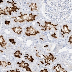 SLC22A13 Antibody, Novus Biologicals:Antibodies:Primary Antibodies