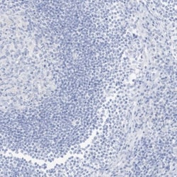 SLC22A13 Antibody, Novus Biologicals:Antibodies:Primary Antibodies