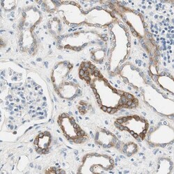 SLC22A2/OCT2 Antibody, Novus Biologicals:Antibodies:Primary Antibodies