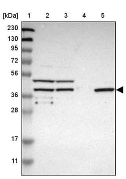 SLC22A23 Antibody, Novus Biologicals 0.1mL; Unlabeled:Antibodies, Polyclonal