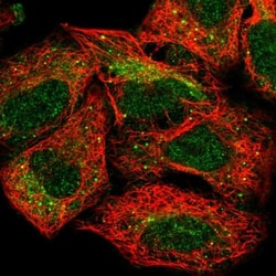 SLC22A3 Antibody, Novus Biologicals 0.1mL; Unlabeled:Antibodies, Polyclonal