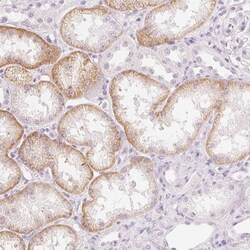 SLC22A8 Antibody, Novus Biologicals 25 &mu;L, Unlabeled:Antibodies, Polyclonal