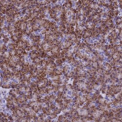SLC24A6 Antibody, Novus Biologicals 0.1mL; Unlabeled:Antibodies, Polyclonal