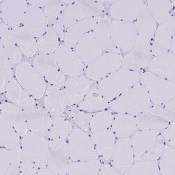 SLC24A6 Antibody, Novus Biologicals 0.1mL; Unlabeled:Antibodies, Polyclonal