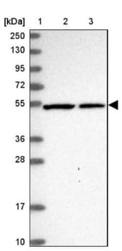 SLC24A6 Antibody, Novus Biologicals 0.1mL; Unlabeled:Antibodies, Polyclonal