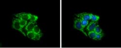 SLC25A1 Antibody, Novus Biologicals 0.1mL; Unlabeled:Antibodies, Polyclonal