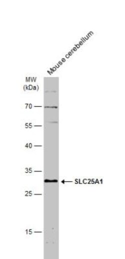 SLC25A1 Antibody, Novus Biologicals 0.1mL; Unlabeled:Antibodies, Polyclonal