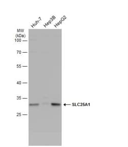 SLC25A1 Antibody, Novus Biologicals 0.1mL; Unlabeled:Antibodies, Polyclonal