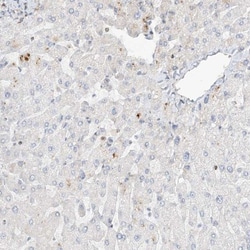 SLC25A12 Antibody, Novus Biologicals 0.1mL; Unlabeled:Antibodies, Polyclonal