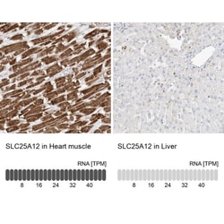 SLC25A12 Antibody, Novus Biologicals 0.1mL; Unlabeled:Antibodies, Polyclonal