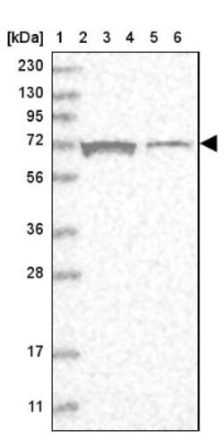 SLC25A12 Antibody, Novus Biologicals 0.1mL; Unlabeled:Antibodies, Polyclonal