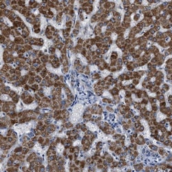 SLC25A13 Antibody, Novus Biologicals 25 &mu;L; Unlabeled:Antibodies, Polyclonal