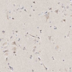 SLC25A26 Antibody, Novus Biologicals 25 &mu;L; Unlabeled:Antibodies, Polyclonal