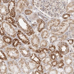 SLC25A26 Antibody, Novus Biologicals 25 &mu;L; Unlabeled:Antibodies, Polyclonal
