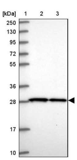 SLC25A45 Antibody, Novus Biologicals 25 &mu;L, Unlabeled:Antibodies, Polyclonal