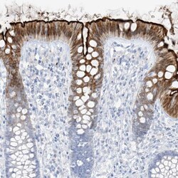SLC26A3 Antibody, Novus Biologicals 25 &mu;L; Unlabeled:Antibodies, Polyclonal