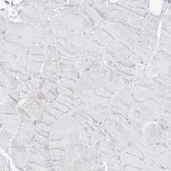 SLC26A3 Antibody, Novus Biologicals 25 &mu;L; Unlabeled:Antibodies, Polyclonal