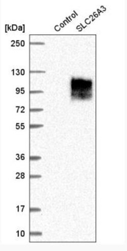 SLC26A3 Antibody, Novus Biologicals 25 &mu;L; Unlabeled:Antibodies, Polyclonal