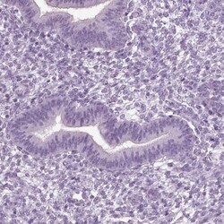 SLC26A8 Antibody, Novus Biologicals 0.1mL; Unlabeled:Antibodies, Polyclonal