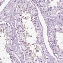 SLC26A8 Antibody, Novus Biologicals 0.1mL; Unlabeled:Antibodies, Polyclonal