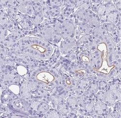 SLC26A9 Antibody, Novus Biologicals:Antibodies:Primary Antibodies