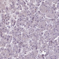 SLC26A9 Antibody, Novus Biologicals:Antibodies:Primary Antibodies
