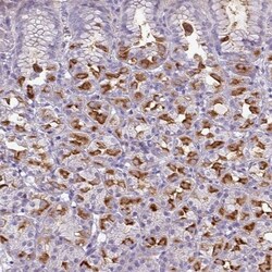 SLC26A9 Antibody, Novus Biologicals:Antibodies:Primary Antibodies