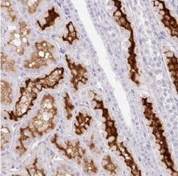 SLC28A1 Antibody, Novus Biologicals 0.1mL; Unlabeled:Antibodies, Polyclonal