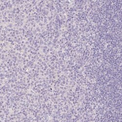 SLC28A1 Antibody, Novus Biologicals 0.1mL; Unlabeled:Antibodies, Polyclonal
