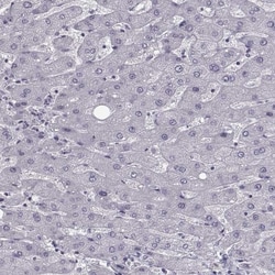 SLC28A2 Antibody, Novus Biologicals 0.1mL; Unlabeled:Antibodies, Polyclonal