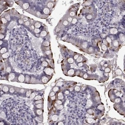 SLC28A2 Antibody, Novus Biologicals 0.1mL; Unlabeled:Antibodies, Polyclonal