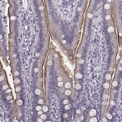 SLC28A2 Antibody, Novus Biologicals 0.1mL; Unlabeled:Antibodies, Polyclonal