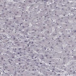 SLC28A2 Antibody, Novus Biologicals 0.1mL; Unlabeled:Antibodies, Polyclonal