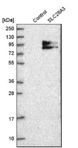 SLC28A3 Antibody, Novus Biologicals 0.1mL; Unlabeled:Antibodies, Polyclonal