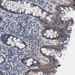 SLC30A1 Antibody, Novus Biologicals 0.1mL; Unlabeled:Antibodies, Polyclonal